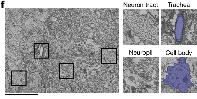 Electron micrograph of a fruit fly brain section with enlarged details of a neuron tract, trachea, neuropil and cell body.